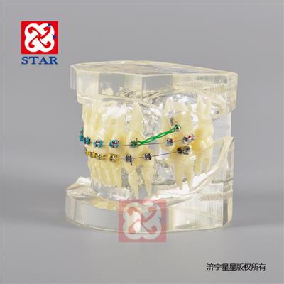 Orthodontic Model M3005-2