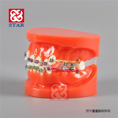 Orthodontic Model M3005