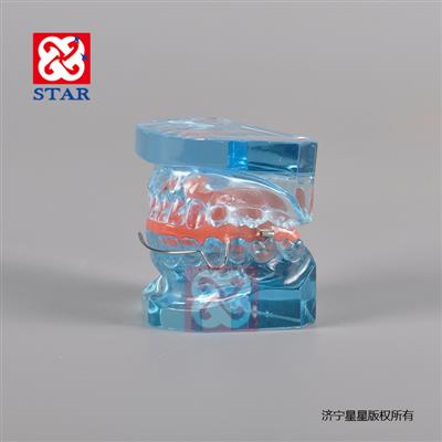 Orthodontic Model with Retainer M3006