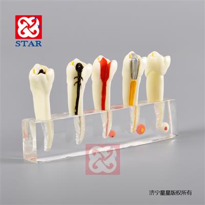 Endodontic ModelM4007