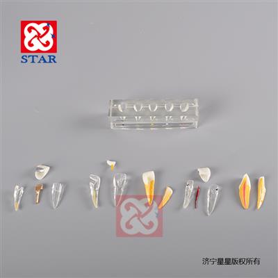 Endodontic Treatment Model Incisor M4008