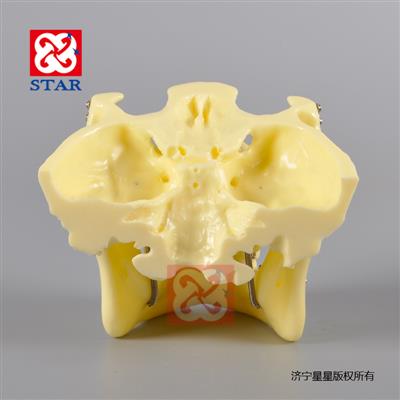 Skull Fracture Model M5004