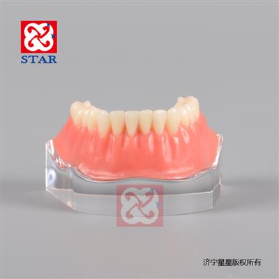 Implant model with golden bar M6008
