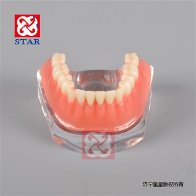 Implant Model with Silver Bar M6009
