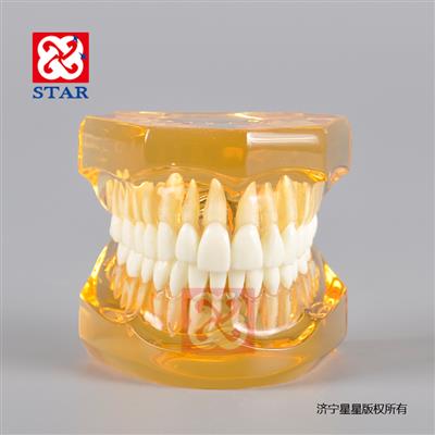 Soft Gum with Removable Teeth M7006