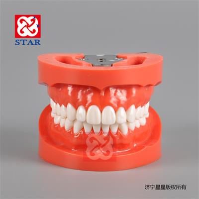 Standard Model with 28 Screwed in Teeth M8009