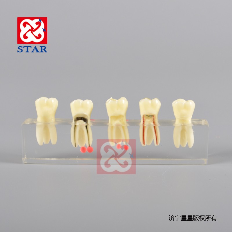 Root Canal Model M4012