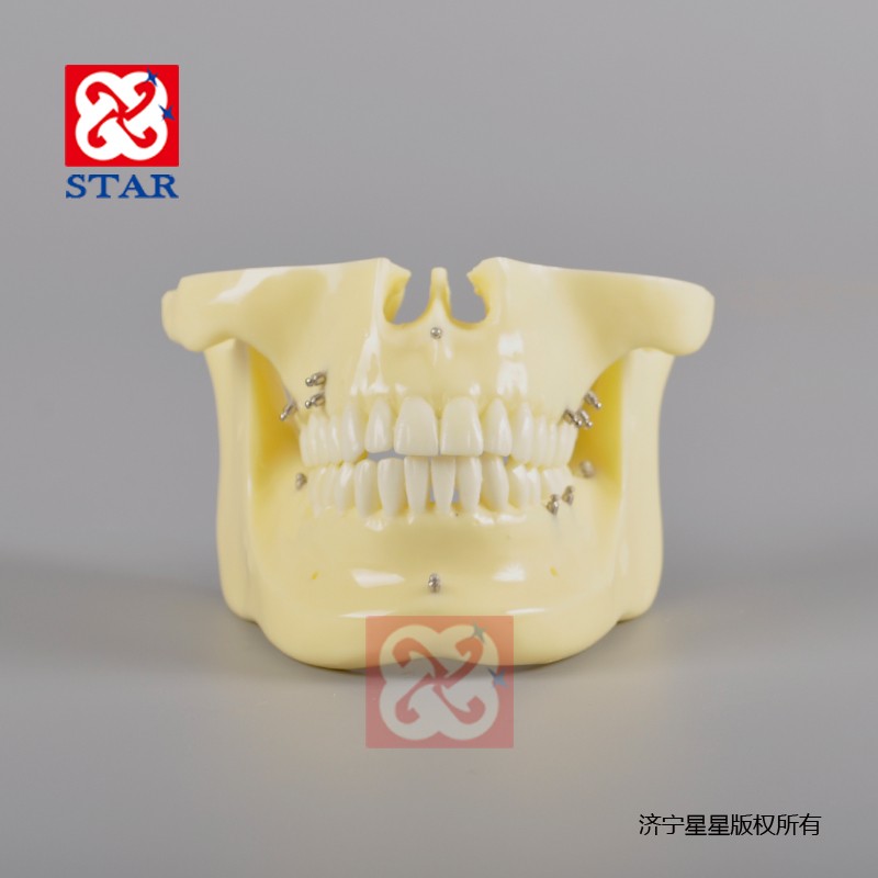 Orthodontic Implant Model M2016