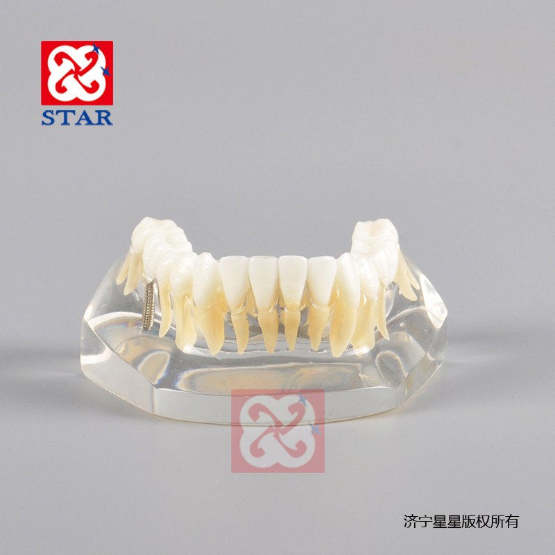 Implant Model Mandibular M2010